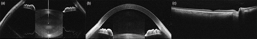 OCT Image at 830 nm
