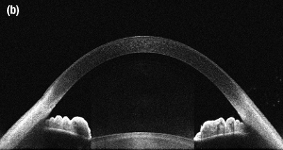830 nm OCT Image